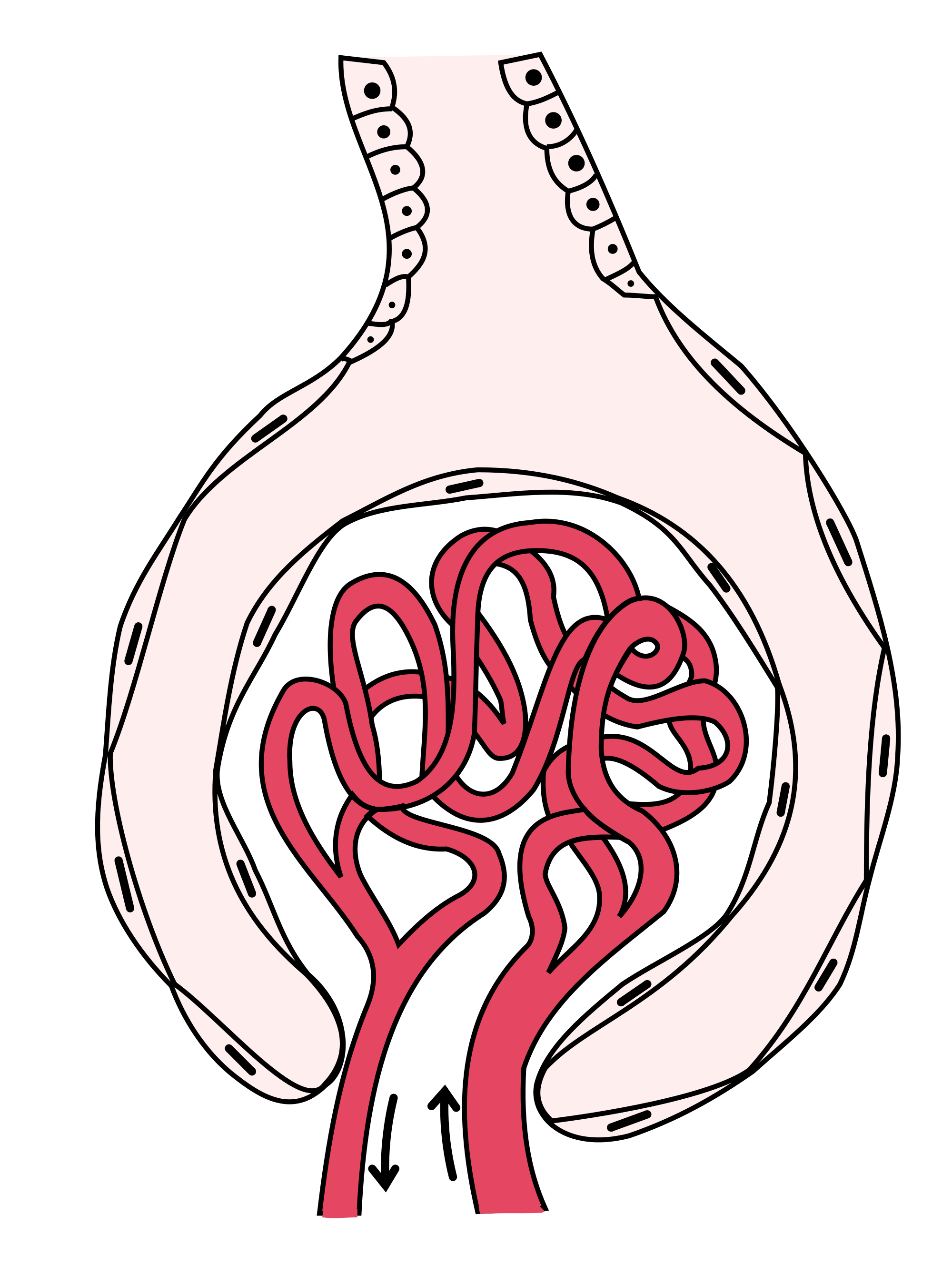 Wikipedia drawing of the. Kidney clipart nephrotic syndrome