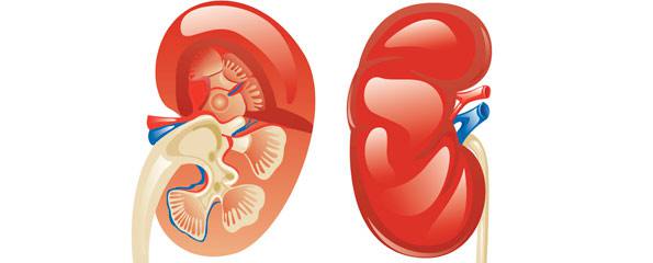 kidney clipart nephrotic syndrome