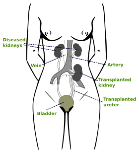 kidney clipart relation