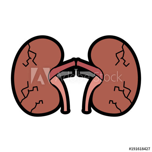 Kidneys human disease medical. Kidney clipart unhealthy