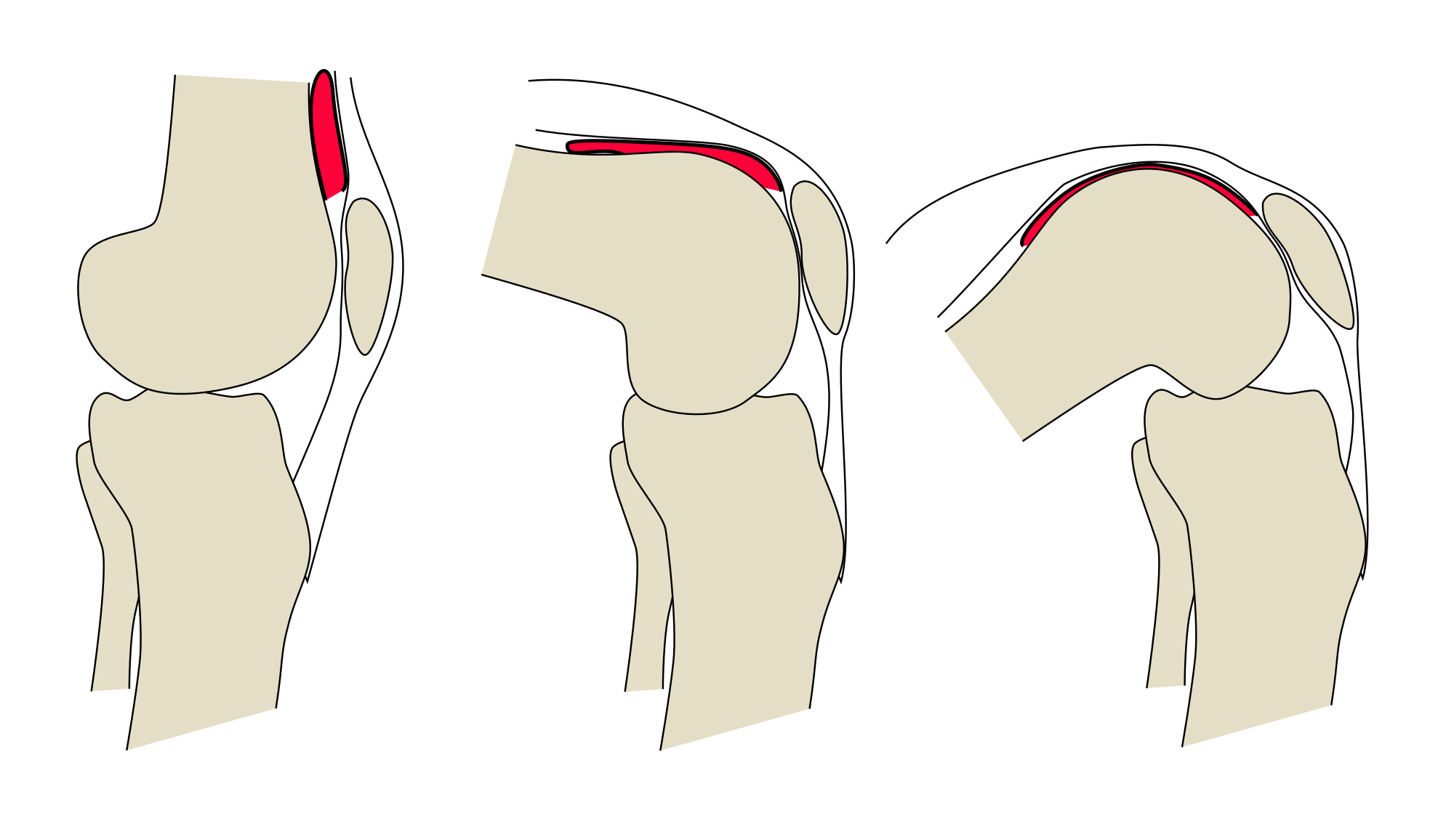 knee clipart bone joint