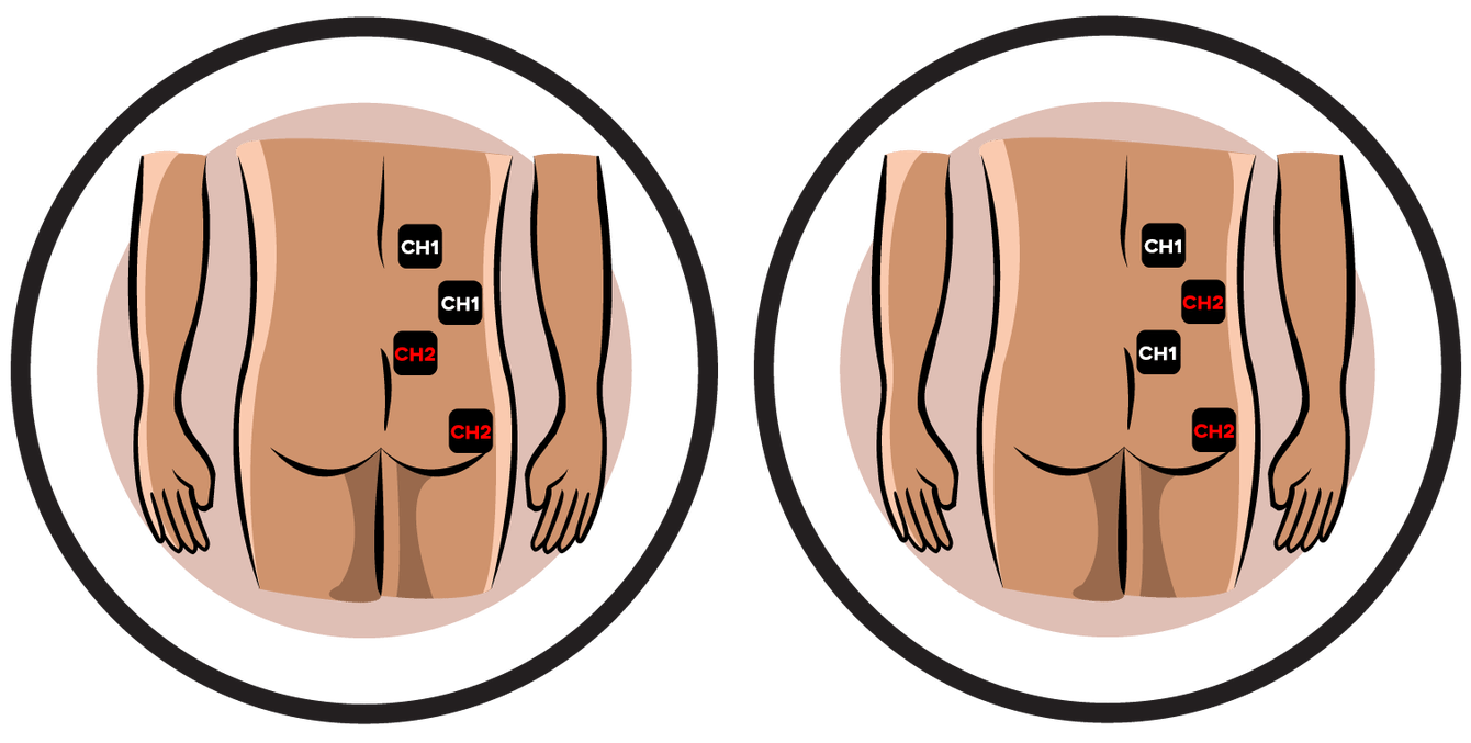 Leg clipart lower limb. Phantom extremity sciatica ireliev