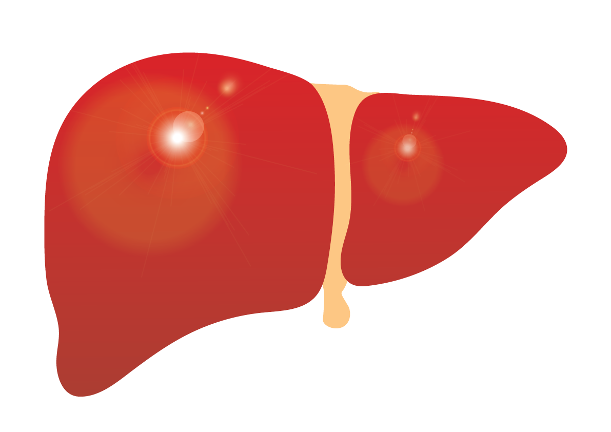 liver clipart cirrhosis
