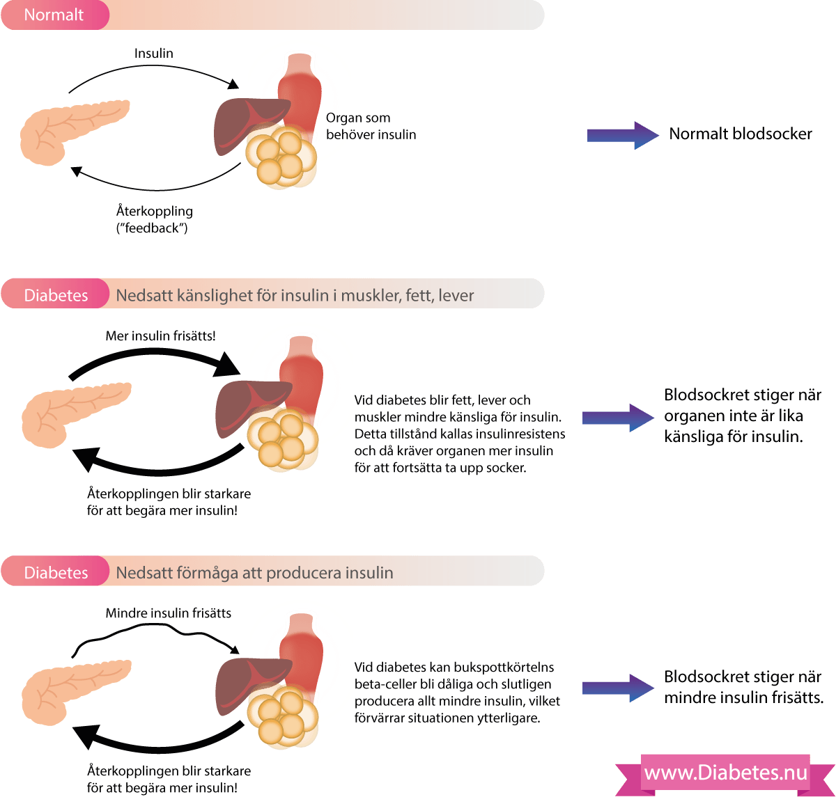 Liver clipart lever. All about type diabetes