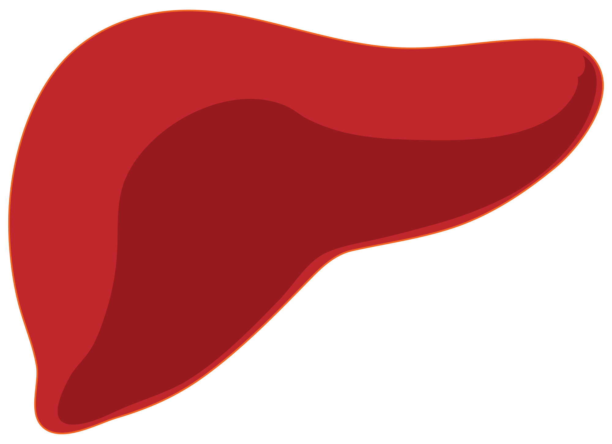 Fatty disease financial tribune. Liver clipart liver damage