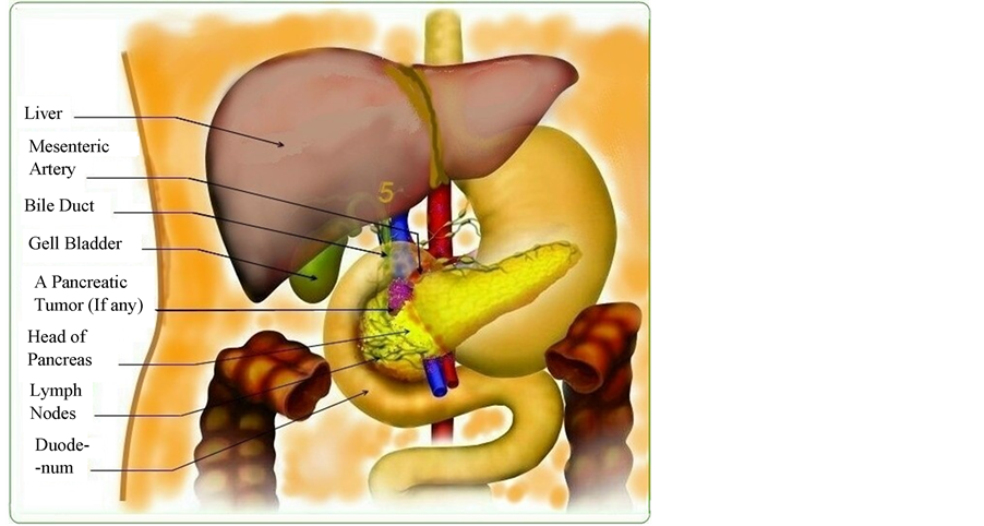 Liver clipart pancreas. Is victory over pancreatic