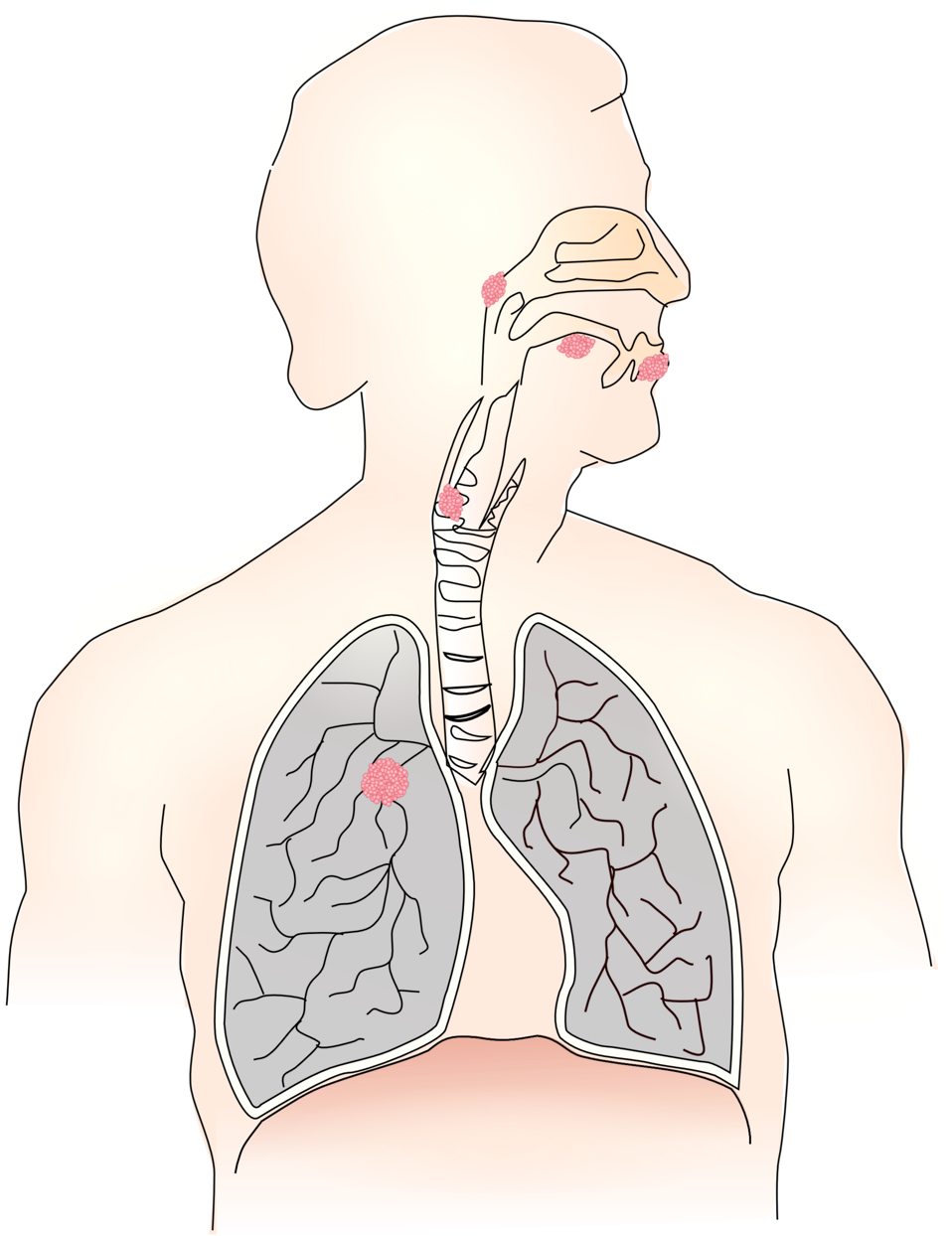 lungs clipart airway