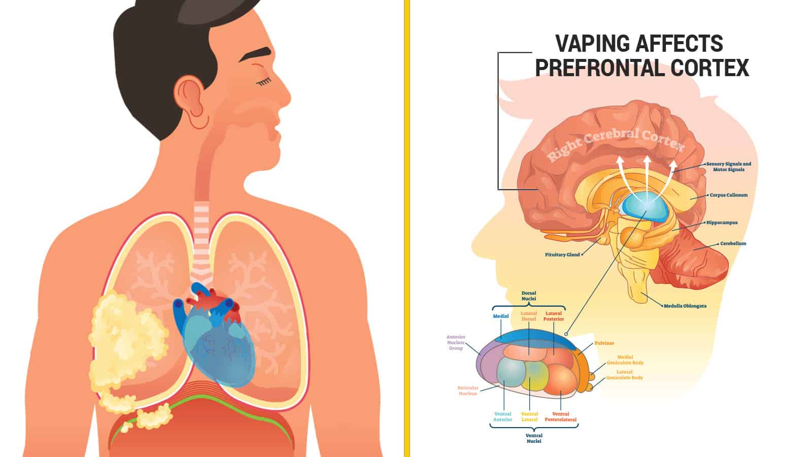Lungs clipart lung damage. Researchers reveal how vaping