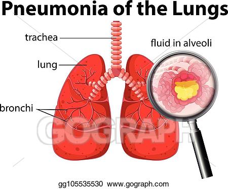 Eps vector of the. Lungs clipart pneumonia