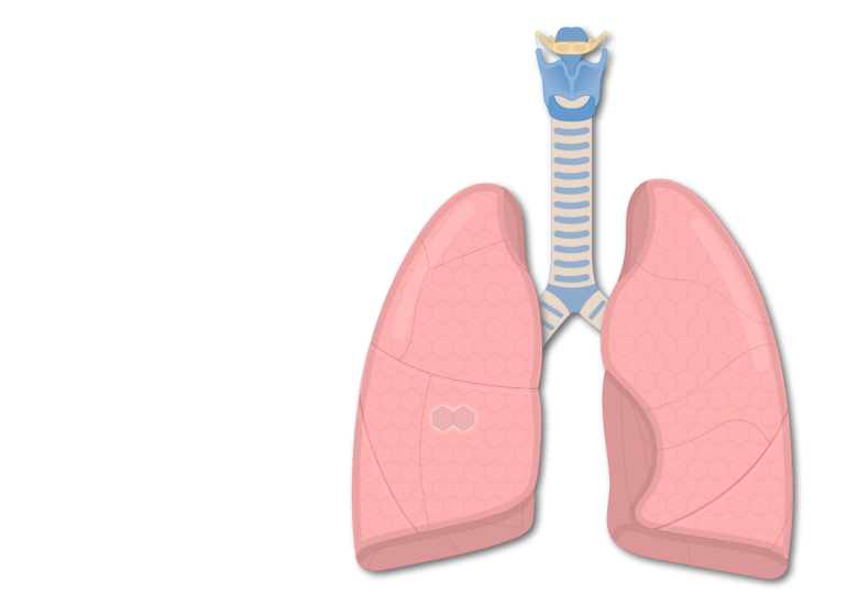 Lungs clipart real lung. Secondary pulmonary lobules of