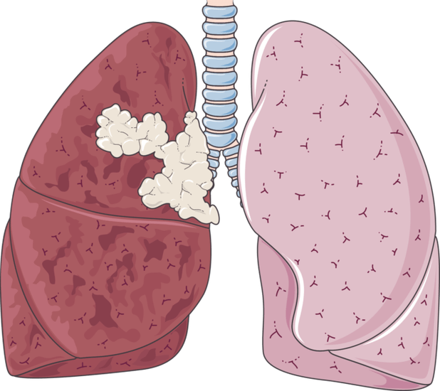 Lungs clipart transparent background. 