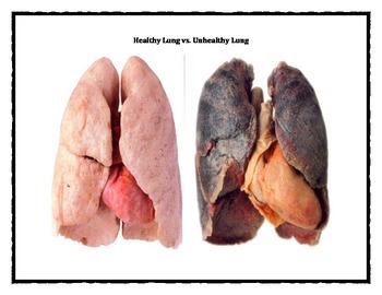 Stylish picture of a. Lungs clipart unhealthy