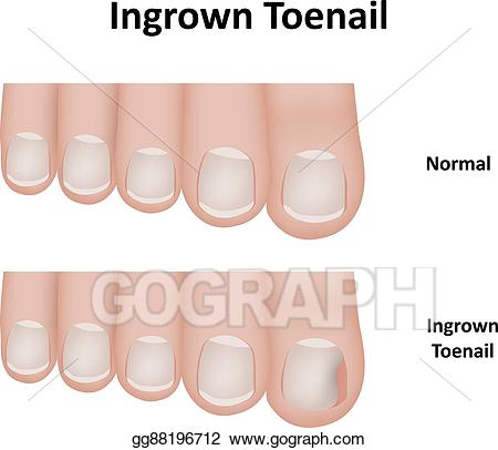 manicure clipart toenail