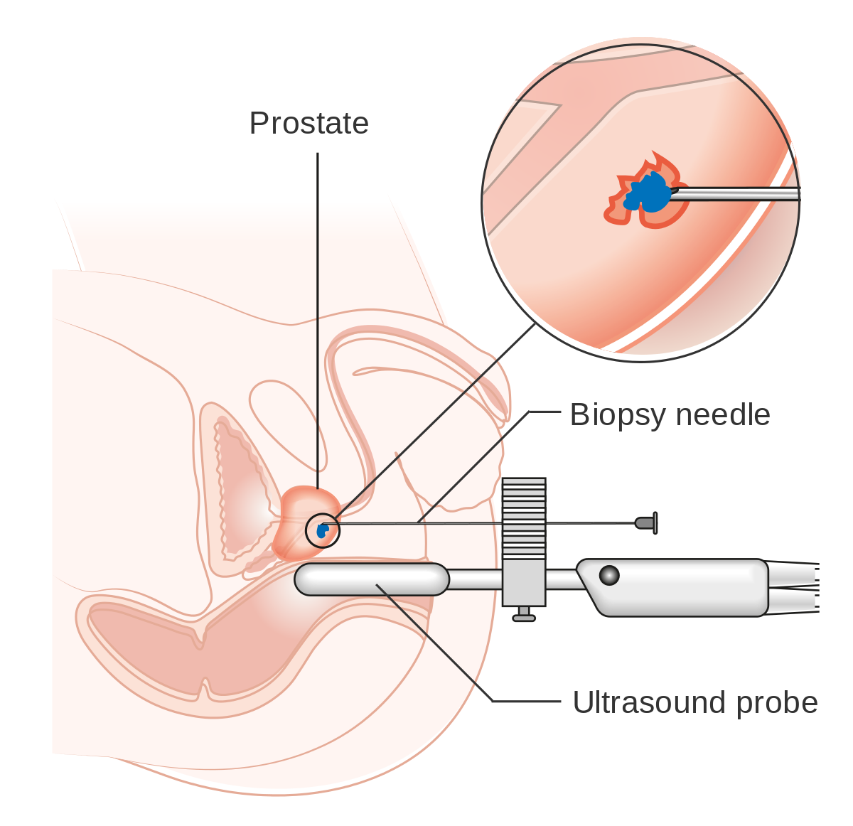 microscope clipart biopsy