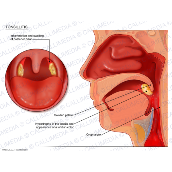 mouth clipart tonsils