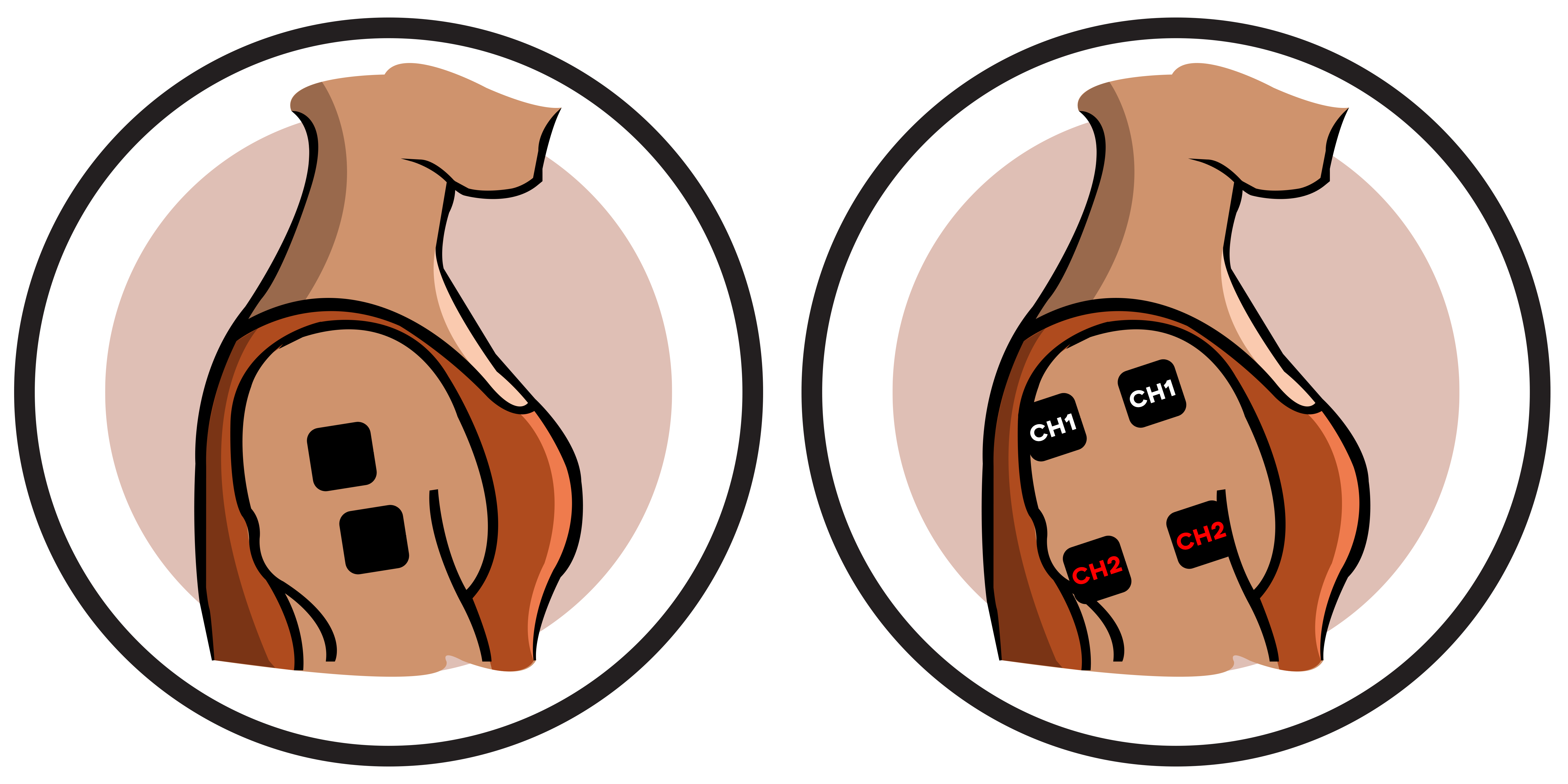 pain clipart shoulder injury