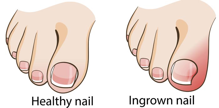 nail clipart toenail