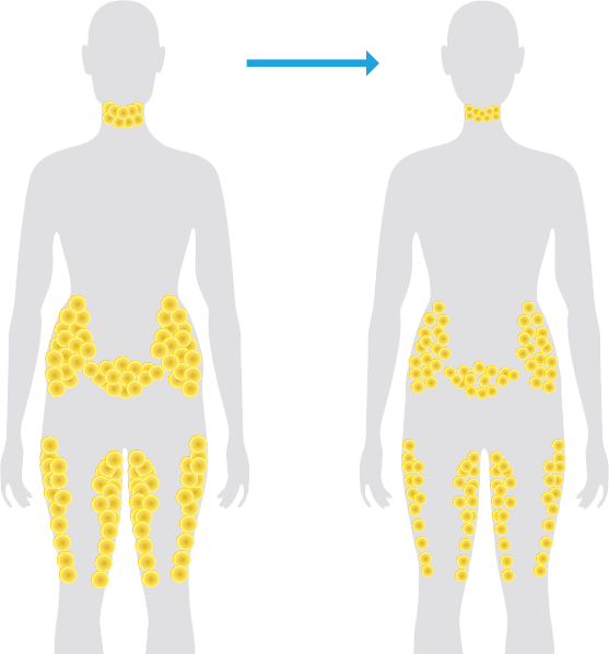 Neck clipart body back. Fat freezing vs weight