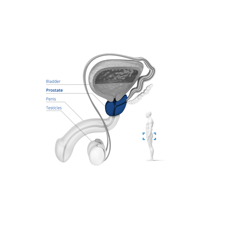 needle clipart biopsy
