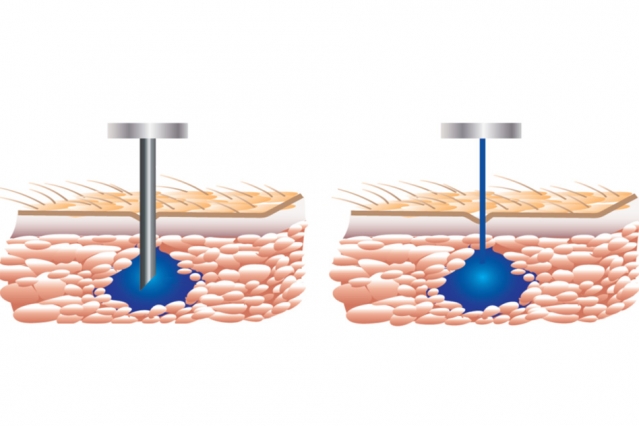 Needle clipart thin object. Startup s free drug