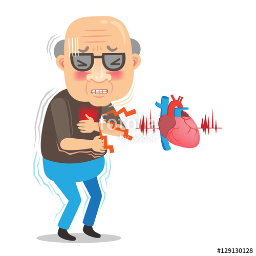 Congestive Heart Failure Clip Art