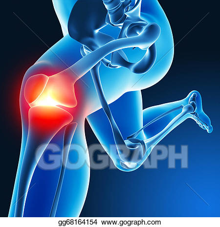 pain clipart joint pain