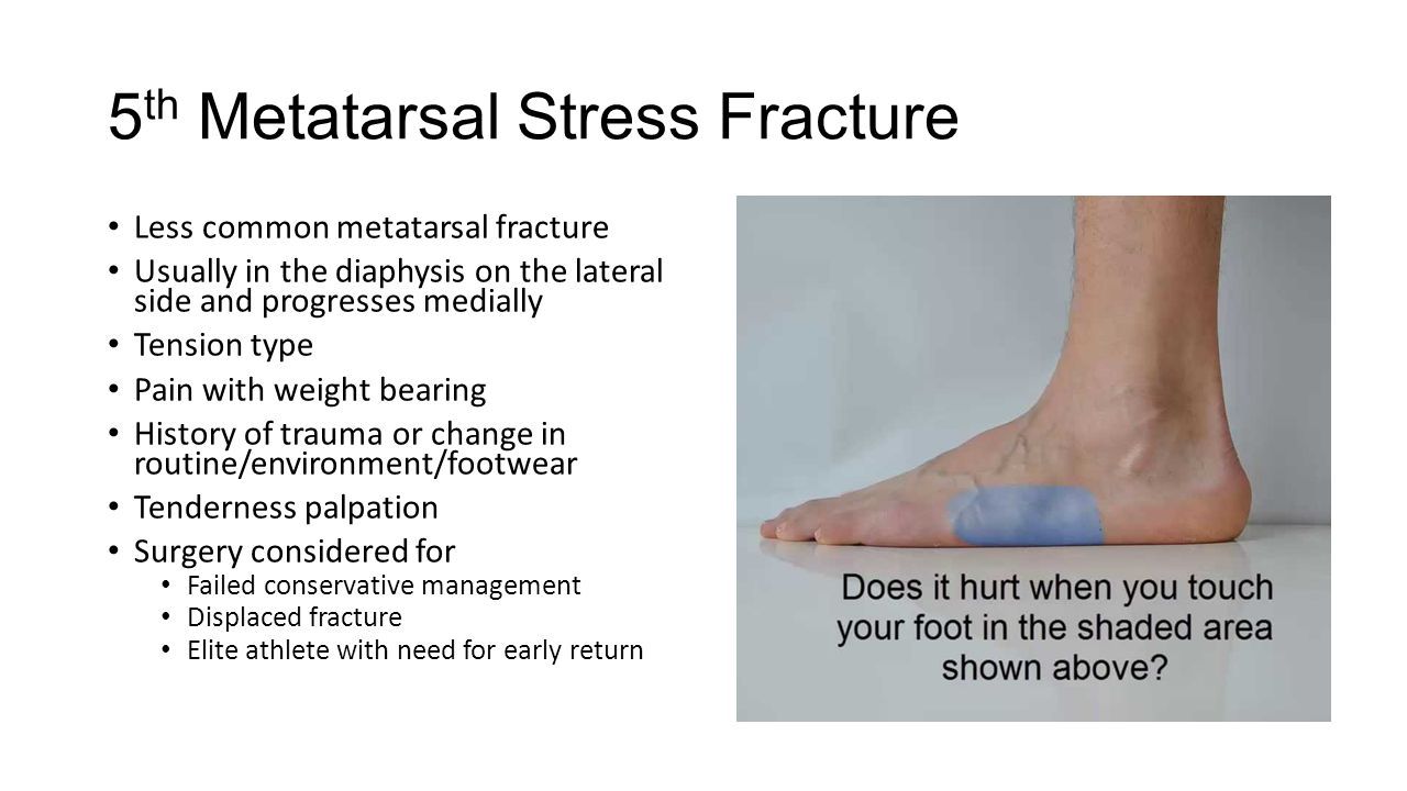 pain clipart stress fracture
