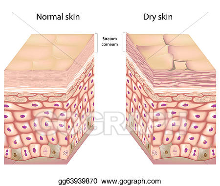 skin clipart dry skin
