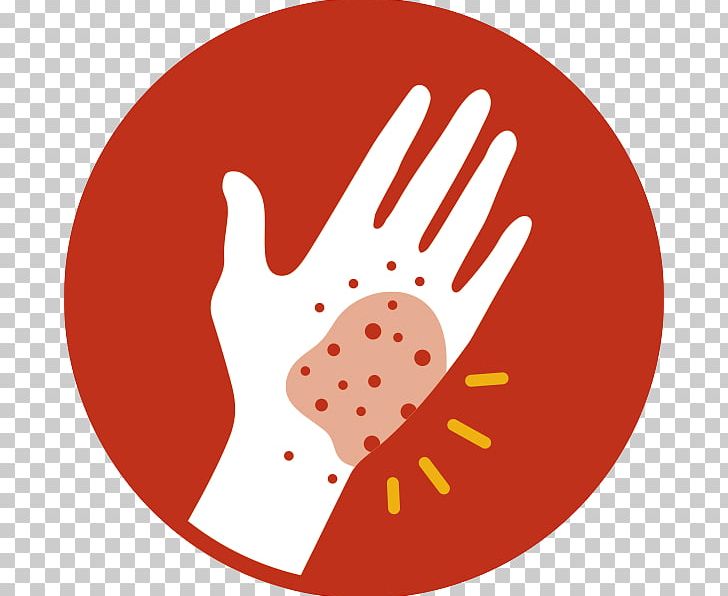 Cutaneous condition therapy disease. Skin clipart skin irritation