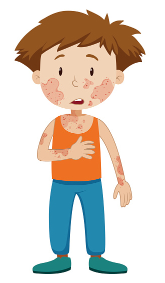 skin clipart skin irritation