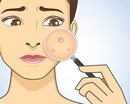 skin clipart skin treatment