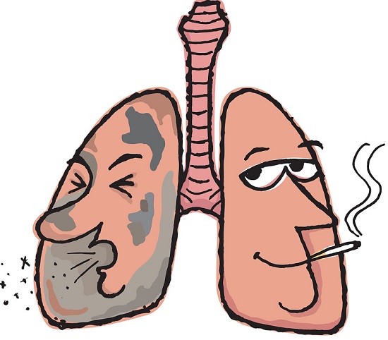 Smoking clipart tobacco effect. A lifestyle malady by
