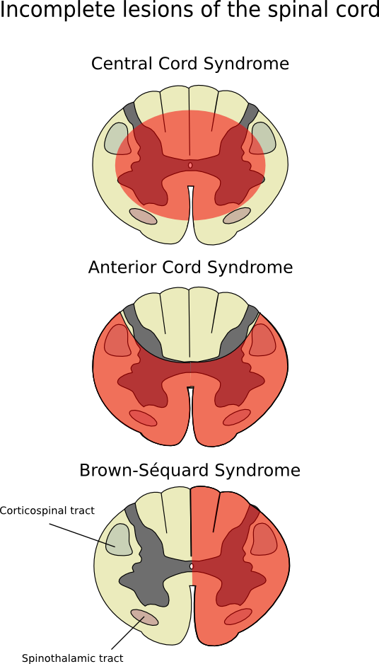 spine clipart brain