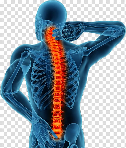 spine clipart spine surgery