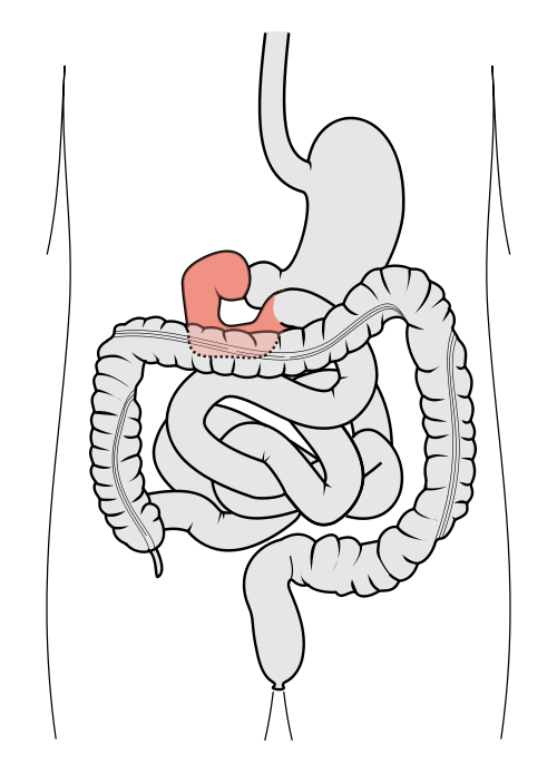 stomach clipart chyme