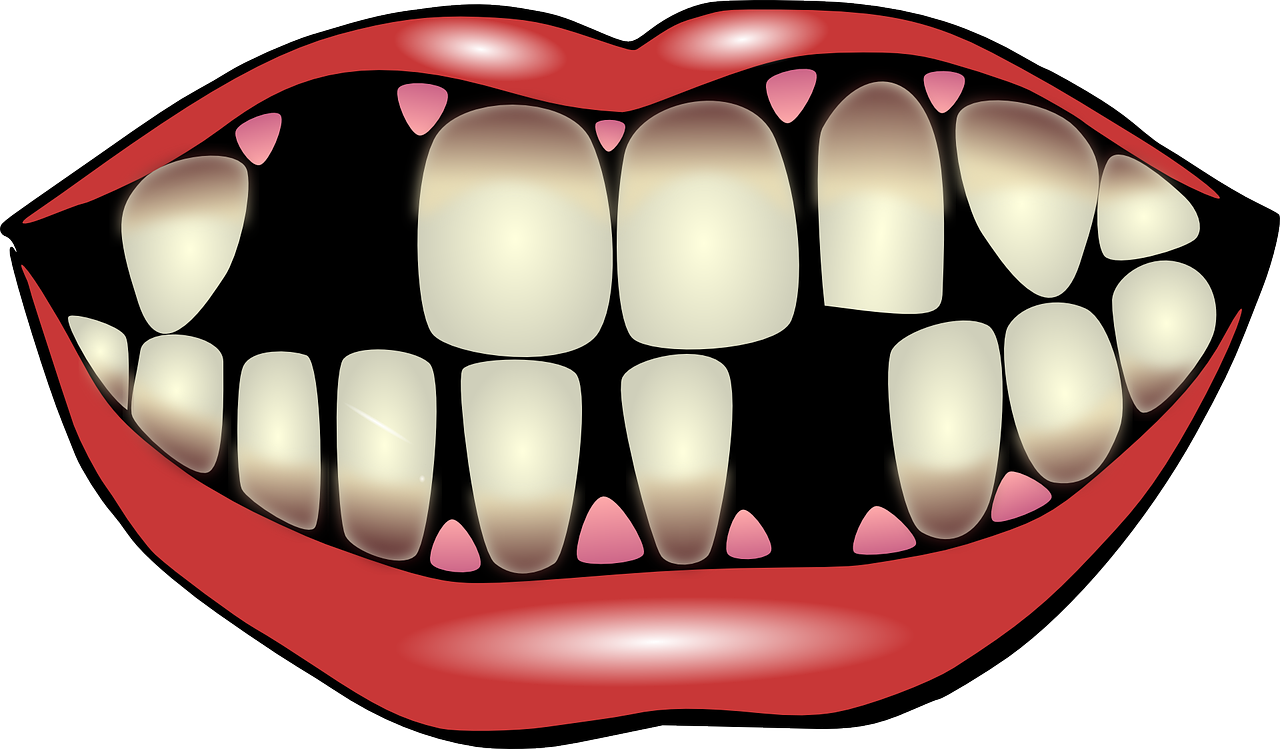 Tags. tooth clipart dental checkup 2140793. 