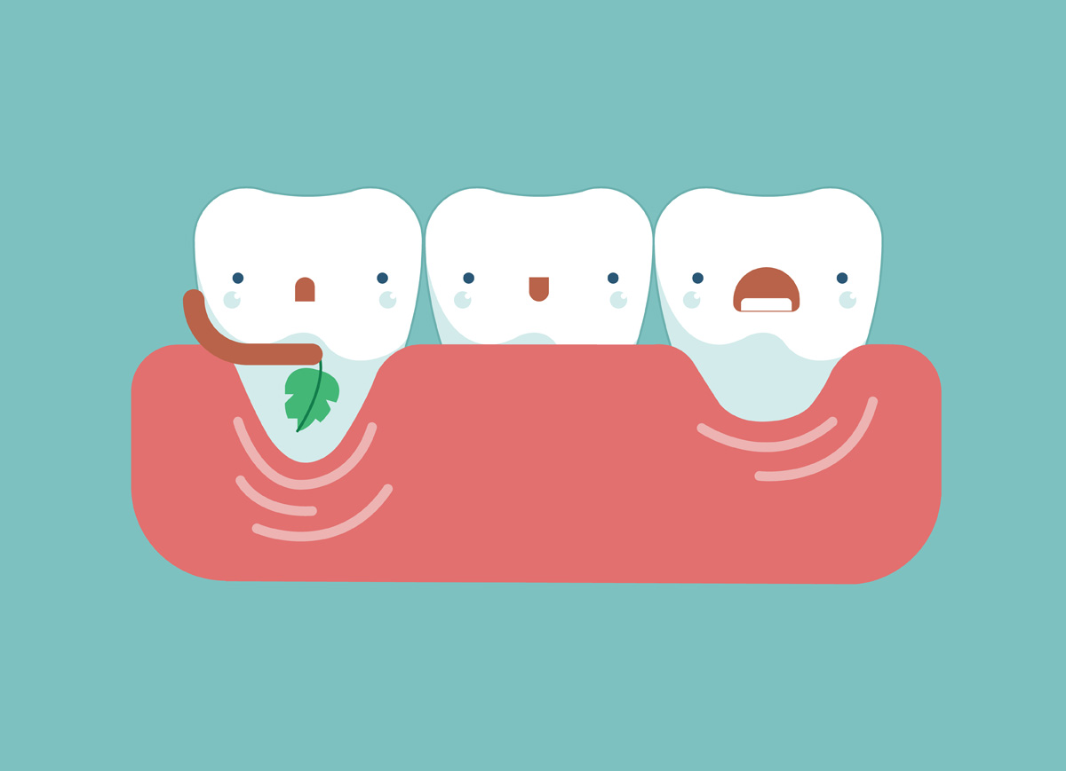 tooth clipart gingivitis
