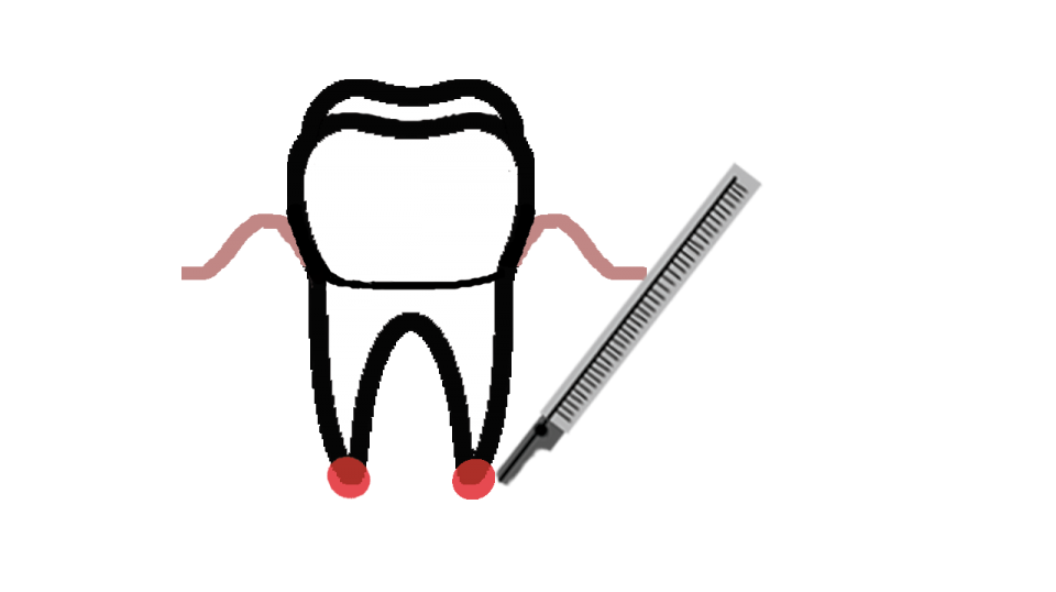 tooth clipart maxillofacial surgery