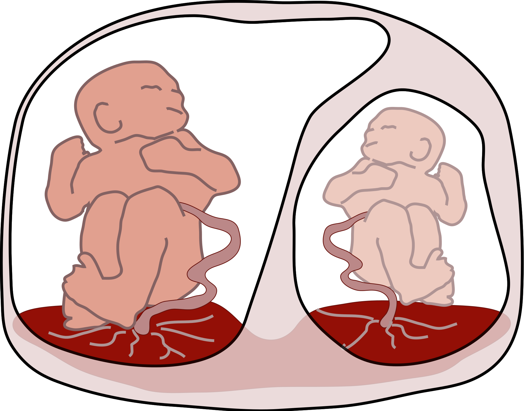 twins clipart identical