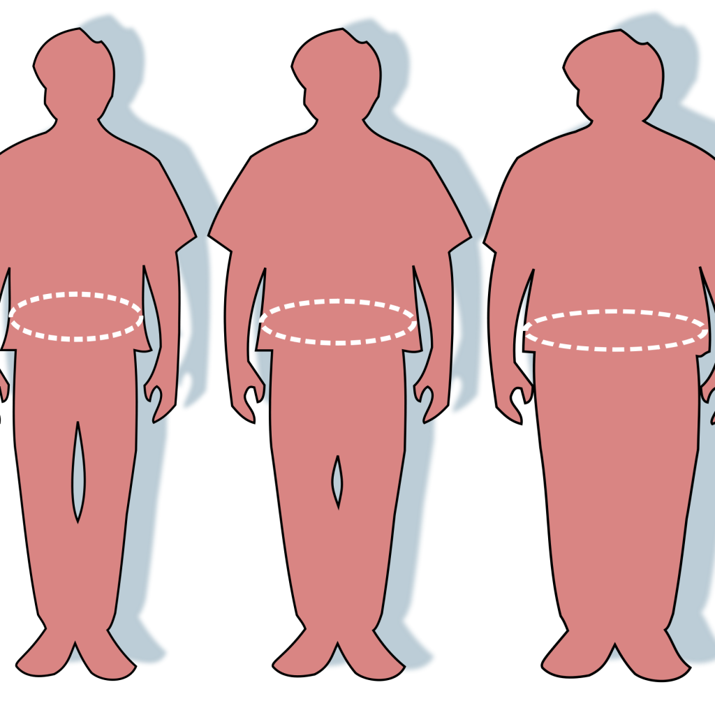 Weight clipart dyslipidemia. Obesity dr gayatri pxobesitywaistcircumferencesvg