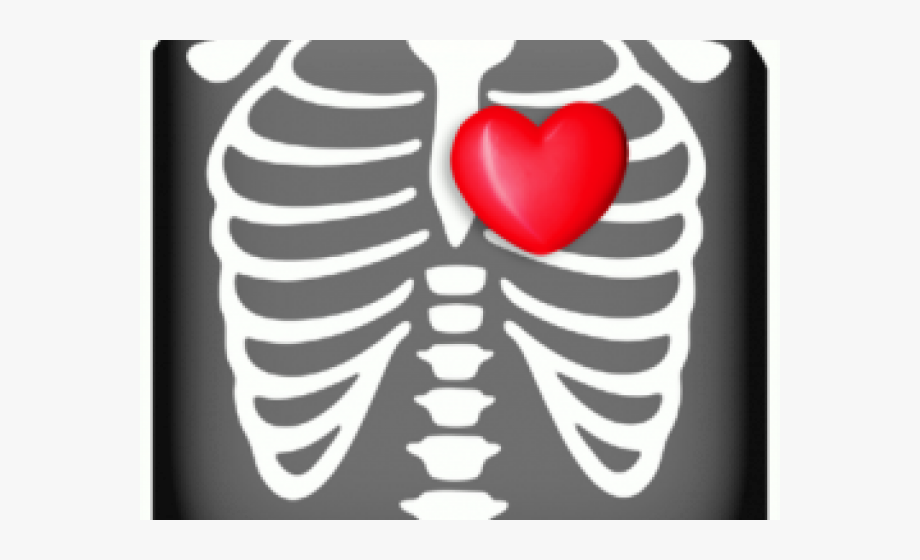 X ray chest png. Xray clipart heart