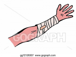 Drawing - Hand drawn bandaged arm. Clipart Drawing gg72126307 - GoGraph