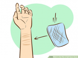 6 Ways to Get Rid of Self Harm Scars - wikiHow