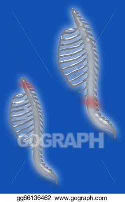 Drawing - Back and neck pain. Clipart Drawing gg66136462 - GoGraph