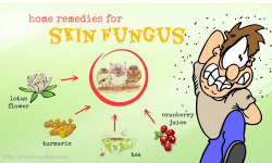 22 Natural Home Remedies For Skin Fungus On Hands, Thighs & Legs