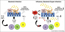 The immunology of influenza virus-associated bacterial pneumonia ...
