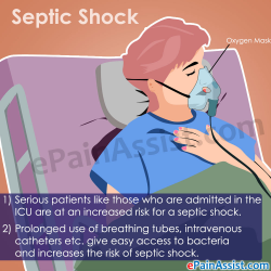Septic Shock: Treatment, Signs, Symptoms, Causes, Risk Factors