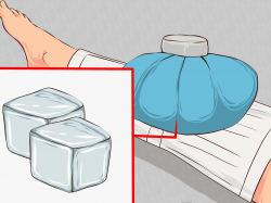 4 Ways to Apply First Aid without Bandages - wikiHow