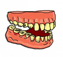 Decayed teeth clip art clipart