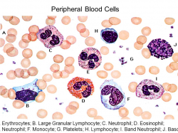 Normal Red Blood Cells - Peripheral Blood Smear - ppt video online ...